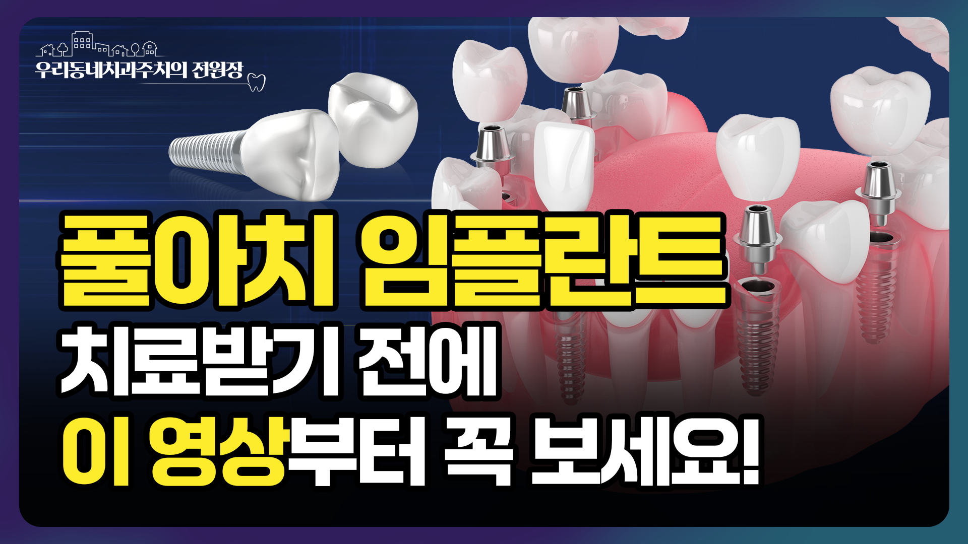 썸네일 3