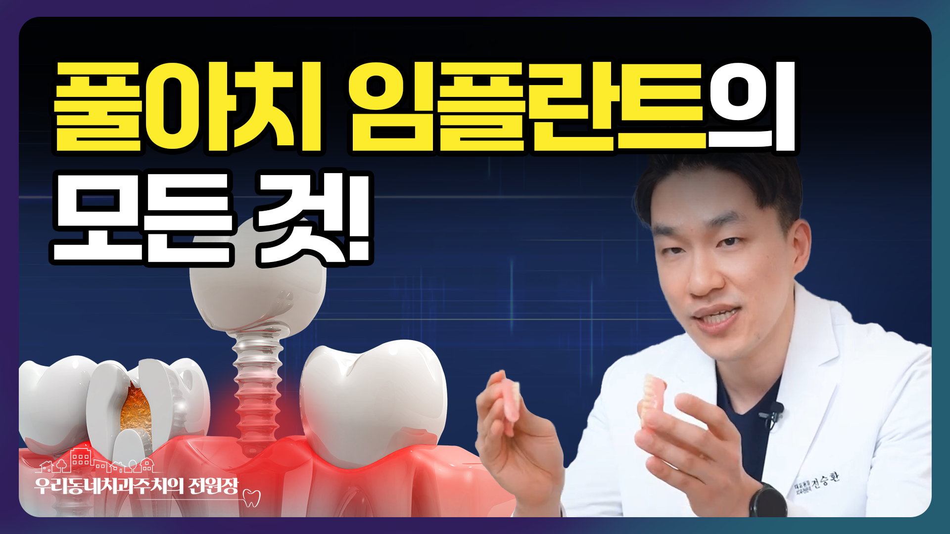 썸네일 4